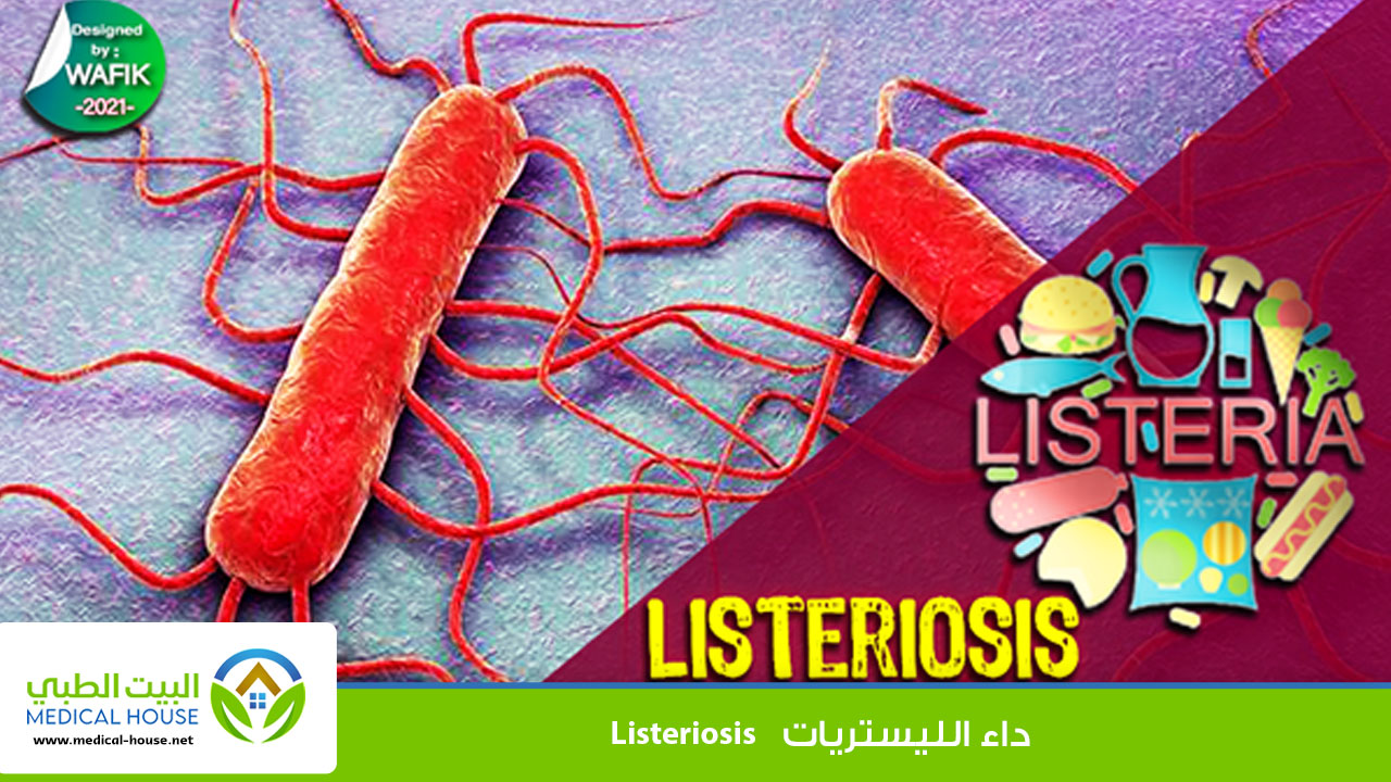 داء الليستريات Listeriosis
